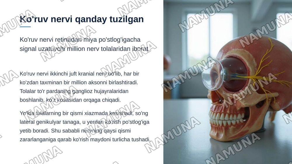 Ko’ruv nervi kasalliklari — zamonaviy taqdimot, 4-slayd