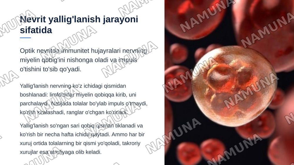 Ko’ruv nervi kasalliklari — zamonaviy taqdimot, 7-slayd