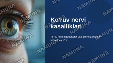Ko’ruv nervi kasalliklari — zamonaviy taqdimot