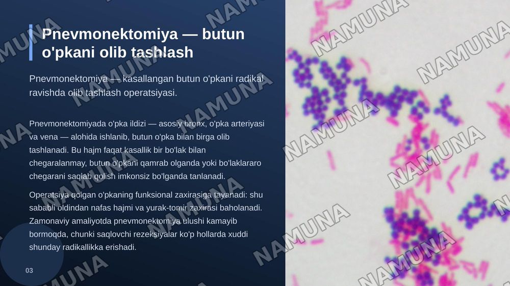 Pnevmonektomiya o’pkadagi radikal operatsiyalar lobektomiya — zamonaviy taqdimot, 4-slayd