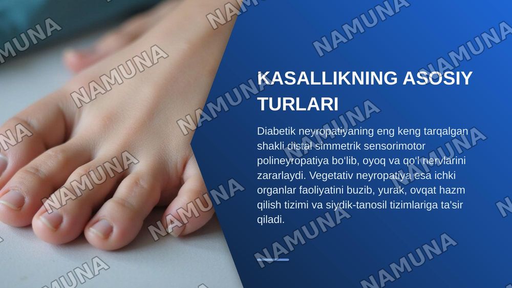 Diabetik neyropatiya — zamonaviy taqdimot, 4-slayd