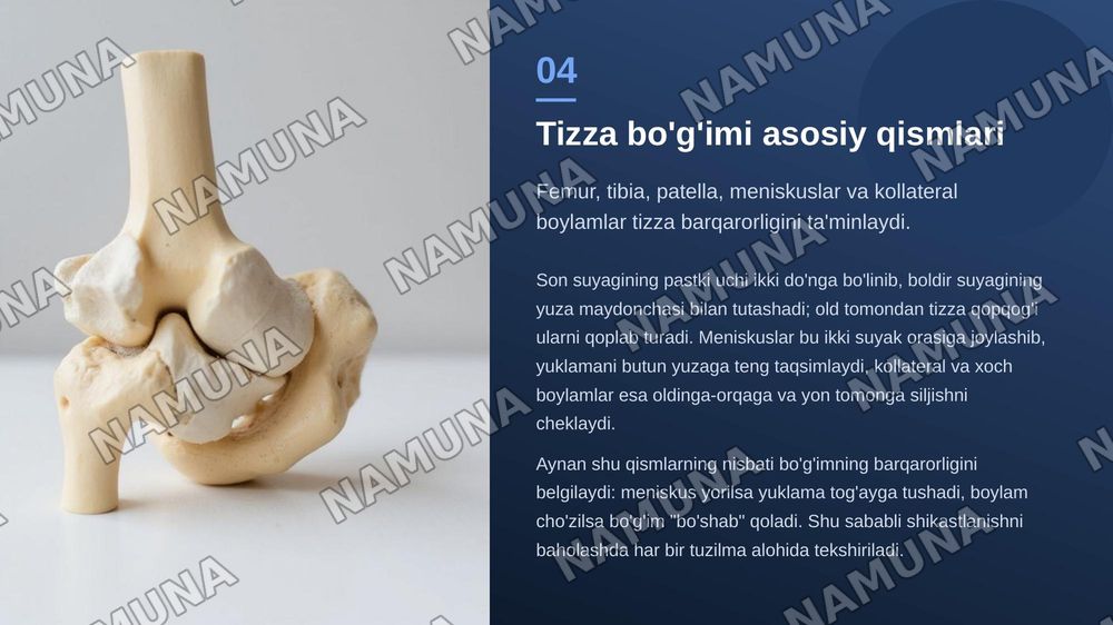 Tizza bo’g’imi — zamonaviy taqdimot, 5-slayd