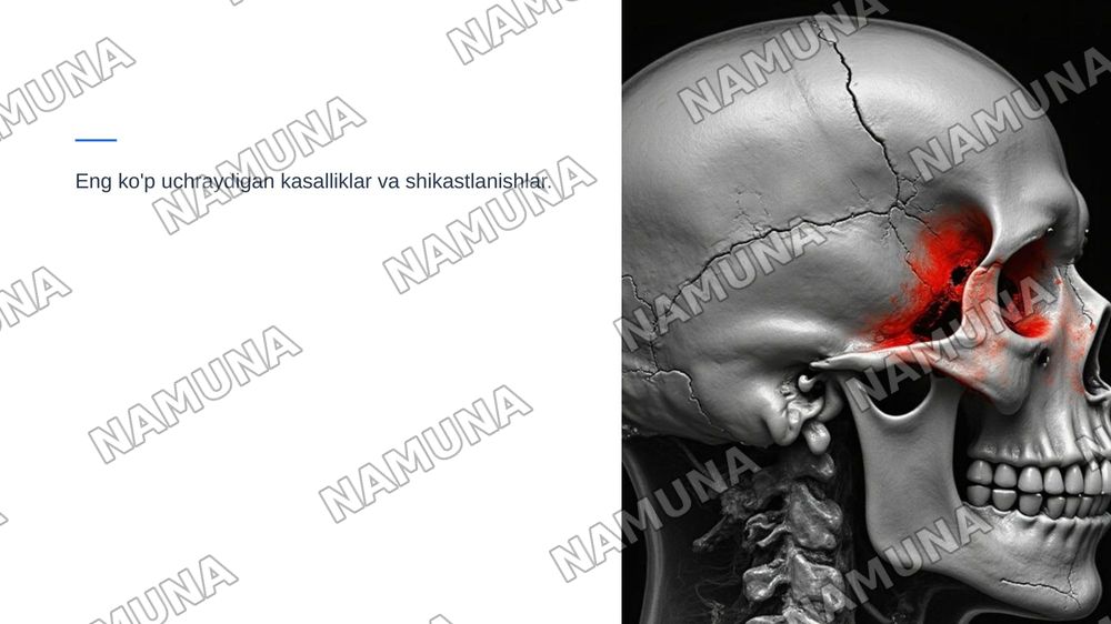 Ponasimon suyak va chakka suyaklari — zamonaviy taqdimot, 8-slayd