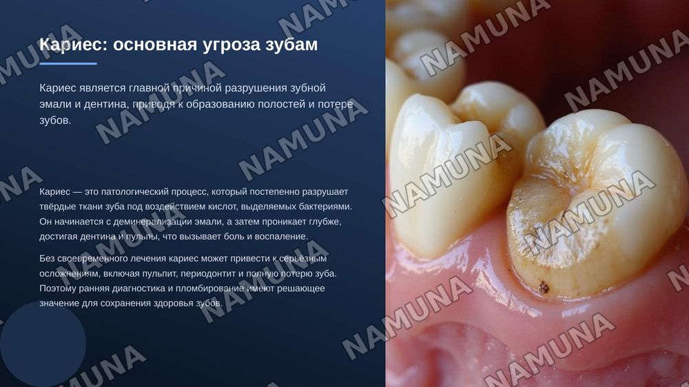 Пломбы — zamonaviy taqdimot, 3-slayd