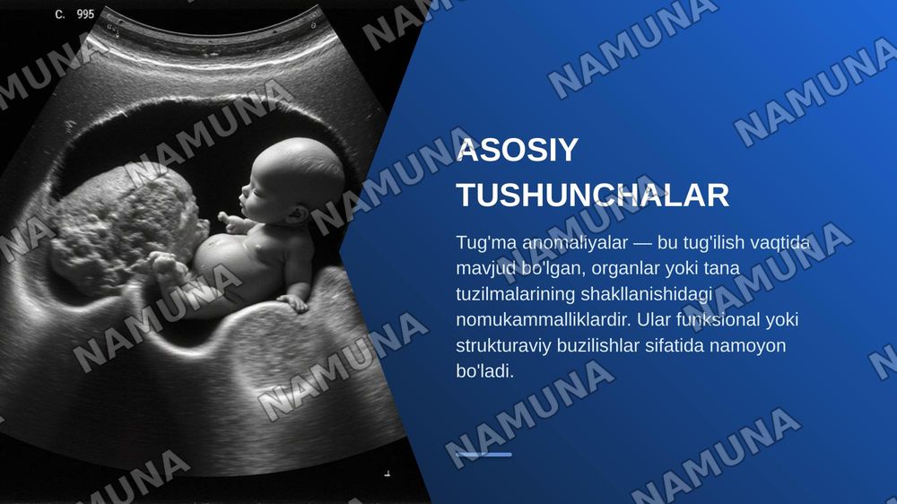 Tug'ma anomaliyalar. Chala tug'ilganlardagi buzilishlar. — zamonaviy taqdimot, 4-slayd