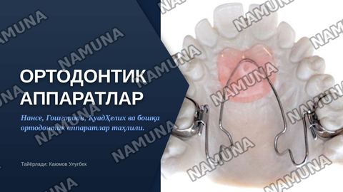 Нансе аппарати. Гошгариан буйича танглай бюгели.QuadHelix, Дерихсвайлер аппарати.Норда аппарати. Лаб бампери, тил ёйи .юз ёйи ( Headgear ,Facebow) — zamonaviy taqdimot