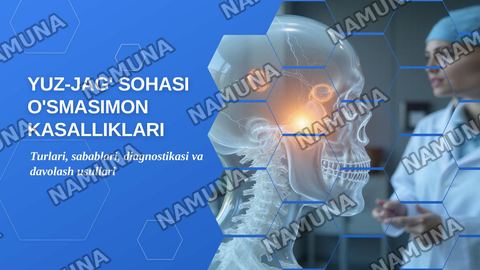 Yuz-jag’ sohasi o’smasimon kasalliklari — zamonaviy taqdimot