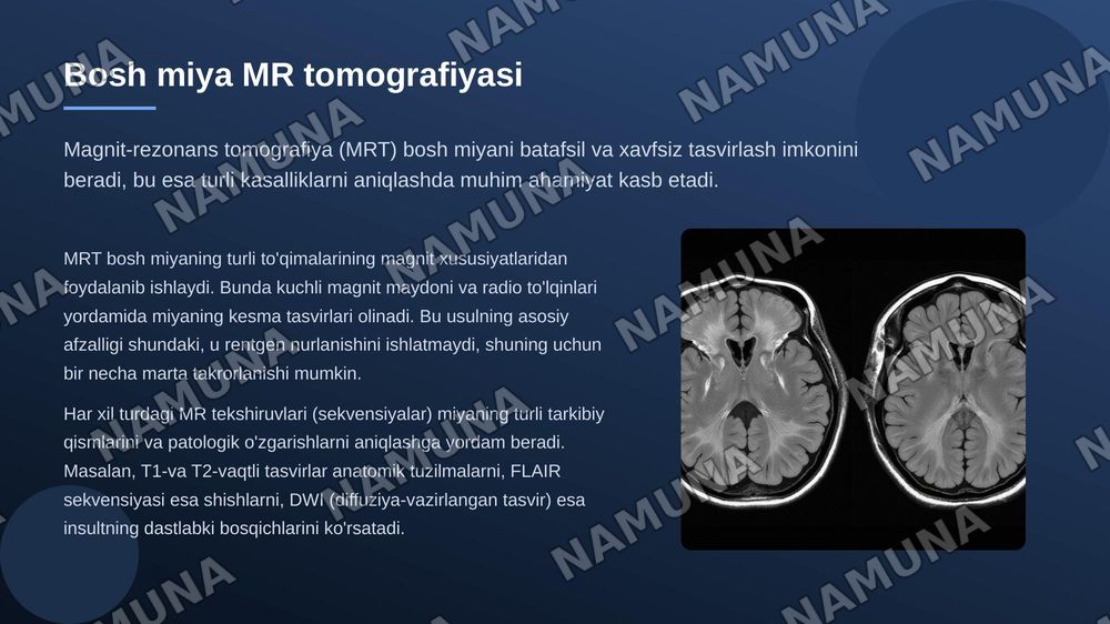 Bosh miya radiologiyasi — zamonaviy taqdimot, 5-slayd