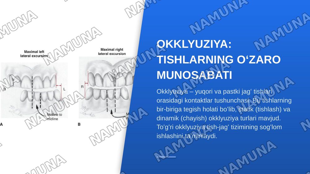 Chakka-pastki jagʻ bo‘gʻimining tuzilishi va xususiyatlari. Pastki jagʻ  biomexanikasi. Yuqori va pastki jagʻ tish qatorlarining o‘zaro munosabati. — zamonaviy taqdimot, 8-slayd