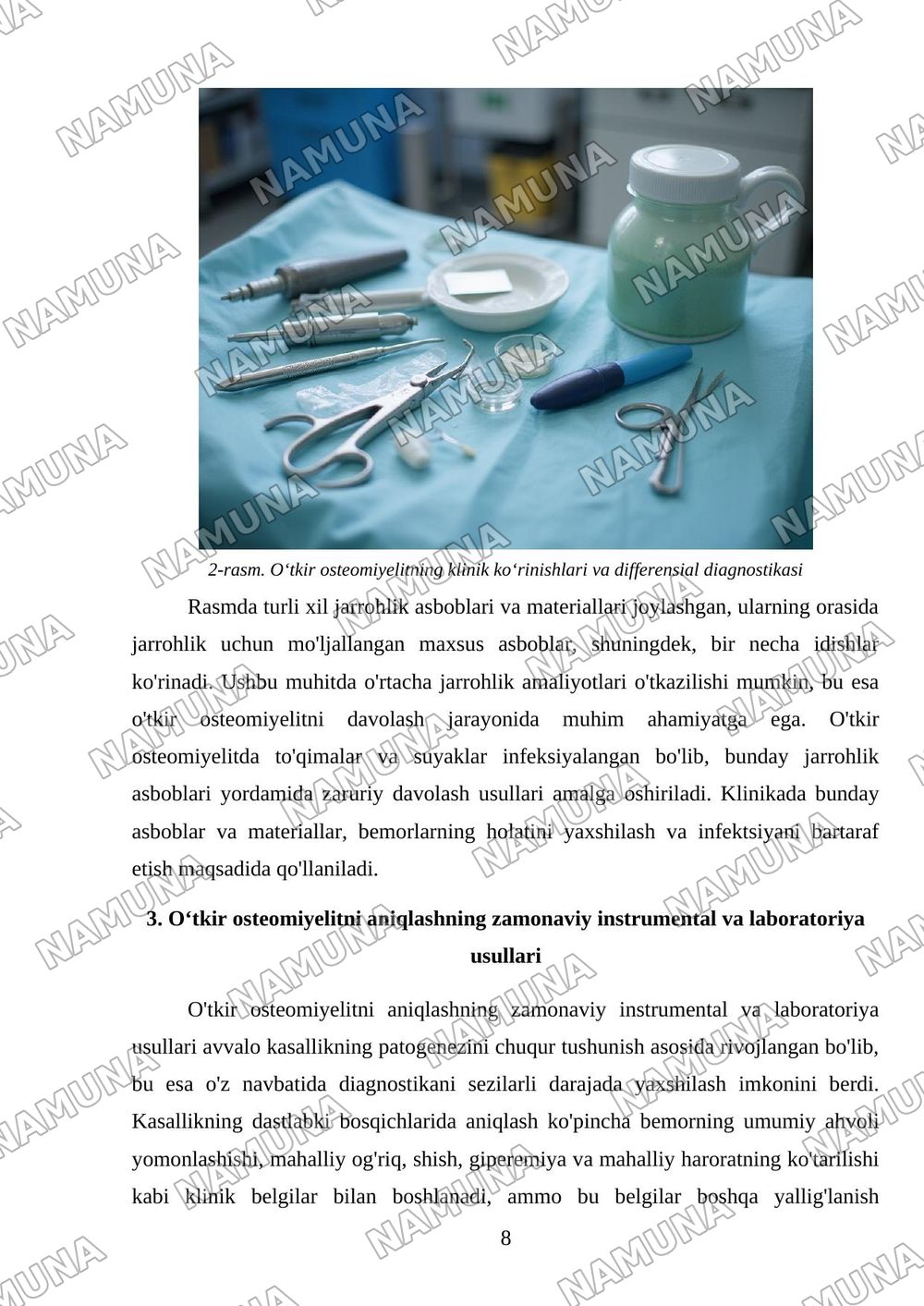 Oʻtkir osteomiyelit : tasnifi ,klinikasi va zamonaviy tekshirish usullari.Oʻtkir osteomiyelitga xos klinik belgilar — mustaqil ish, 8-varaq
