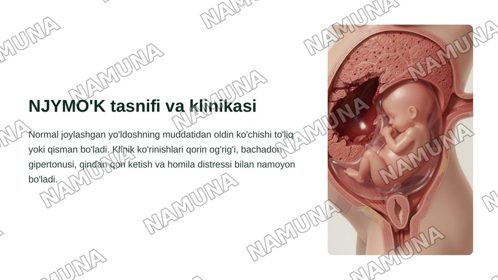 11-Mavzu. Normal joylashgan yo'ldoshning muddatidan oldin ko'chishi. Yo'ldoshning oldinda joylashishi.
Etiopatogenezi, tasnifi, klinikasi, tashxislash, davolash tamoyillari Tug'ruqda vaginal gon ketishlar: bachadon yorilishi. Tasnifi,etiologiya si va patogeneziklinikasi, tashxislash, davolash tamoyi — zamonaviy taqdimot, 5-slayd