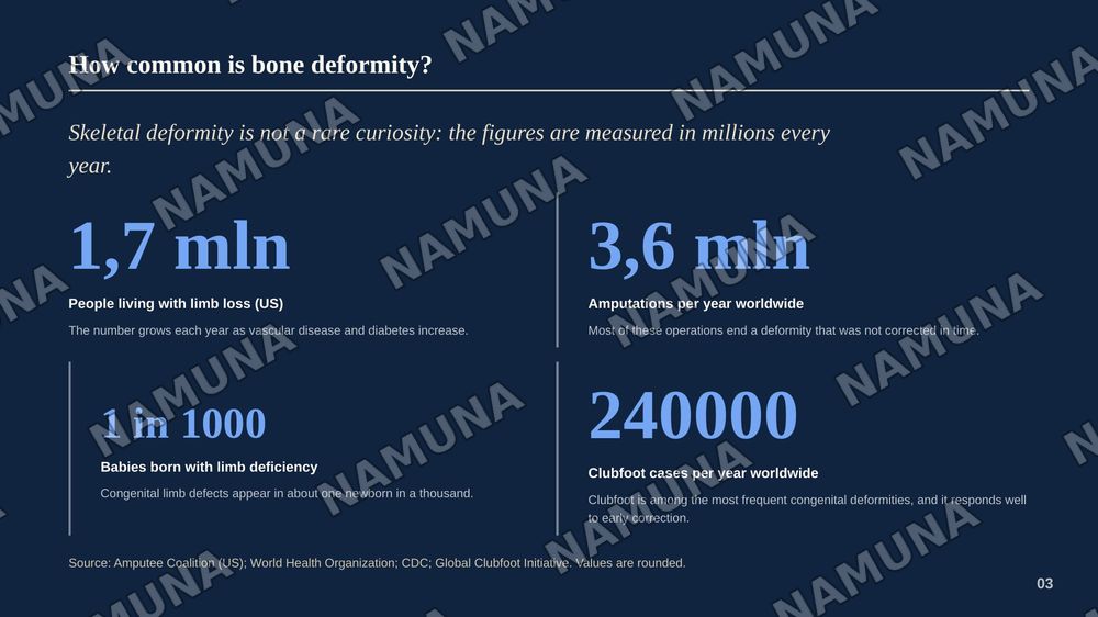 Causes of bone deformity and methods of treatment — zamonaviy taqdimot, 4-slayd