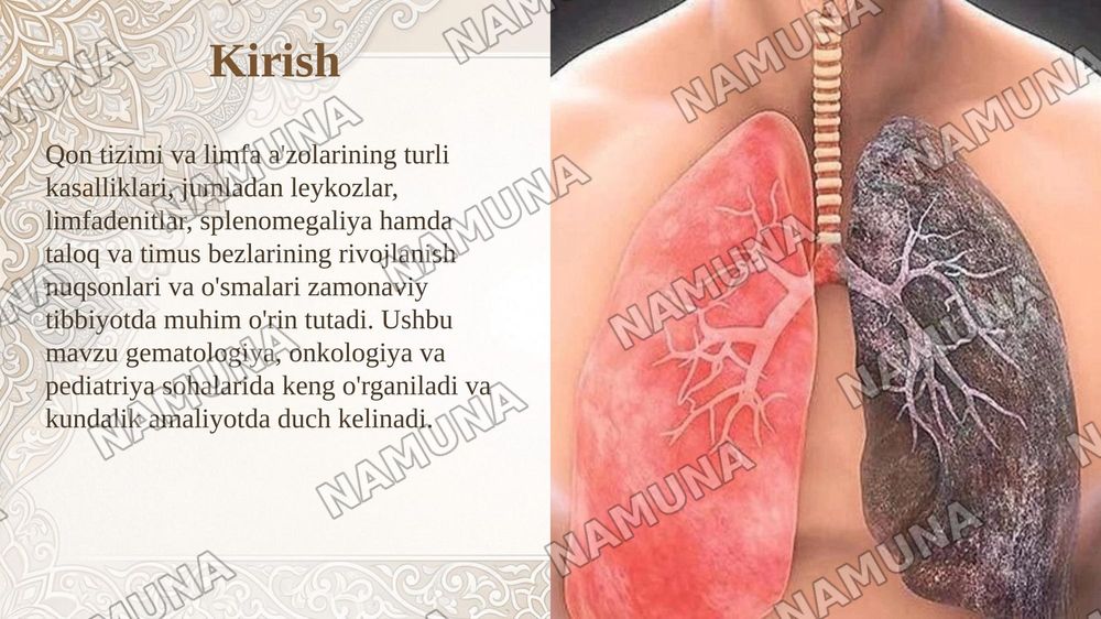 Leykozlar. Limfadenitlar. Splenomegaliya. Taloqning tug’ma anomaliyalari va o’smalari. Timusning rivojlanish buzilishlari. Timus o’smasi. — taqdimot, 3-slayd