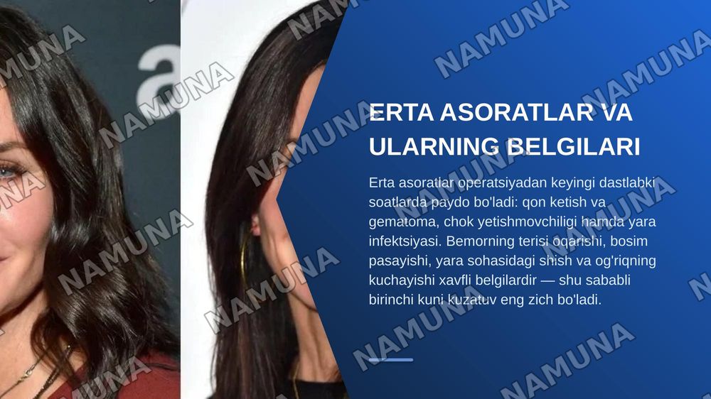 Opetsiyadan keyingi davr tushunchasi operatsiyadan keyingi davr asoratlari — zamonaviy taqdimot, 7-slayd