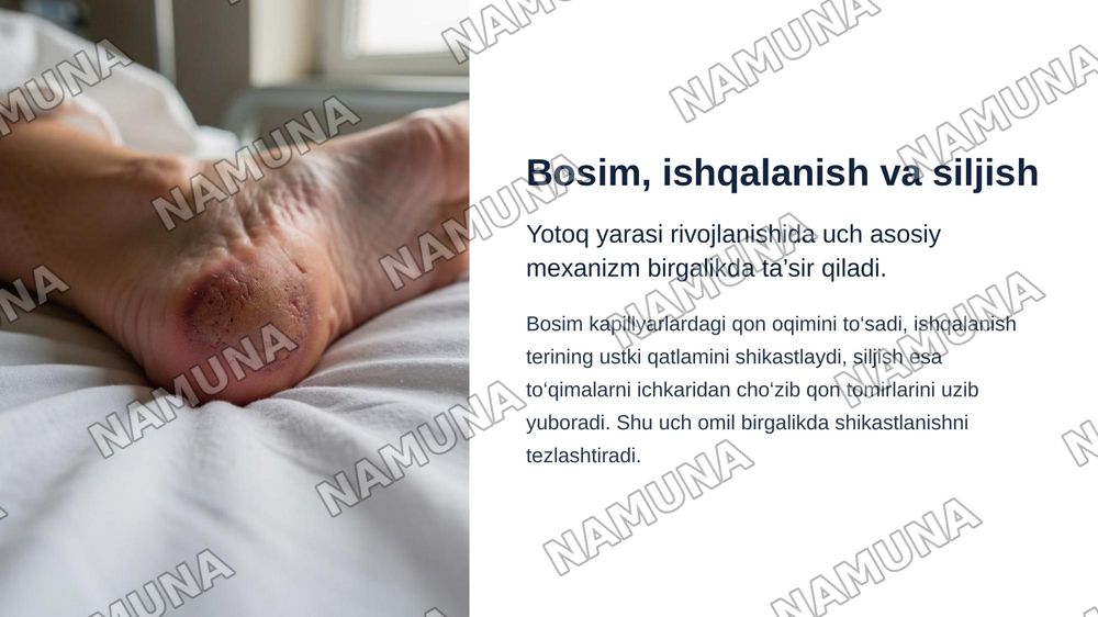 Yotoq yaralari — zamonaviy taqdimot, 5-slayd