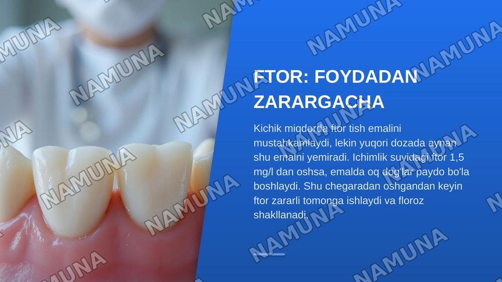 Miroelementozlar. Ftor, kalsiy miqdorlarining oshib ketishi, — zamonaviy taqdimot, 6-slayd