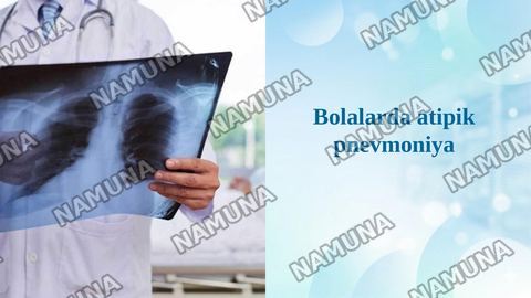 Bolalarda atipik pnevmoniya — taqdimot