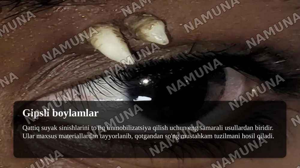Desmurgiya: Boylamlar xaqida umumiy tushuncha,  tasnifi , Bosh,  ko‘krak va tanaga qo‘yiladigan boylamlar. Qo‘l va oyoqlarga qo‘yiladigan boylamlar, gipsli boylamlar — taqdimot, 8-slayd
