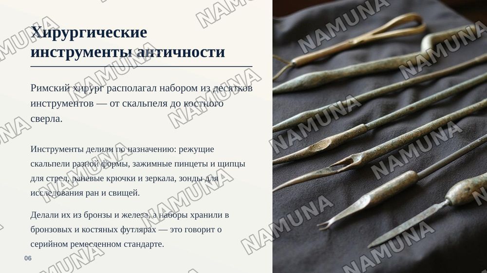 Хирургические методы в Древней Греции и Риме — zamonaviy taqdimot, 7-slayd