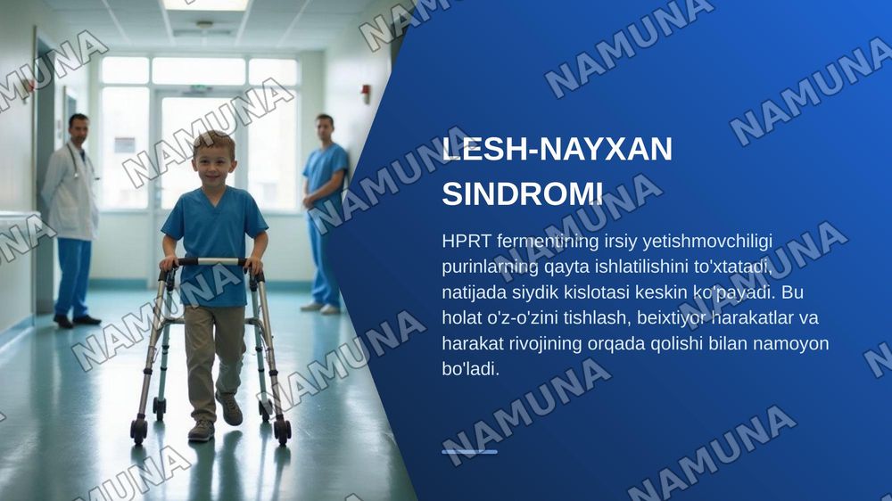 Purin va pirimidin almashinuvining buzilishi natijasida kelib chiqadigan gen kasalliklari. — zamonaviy taqdimot, 6-slayd