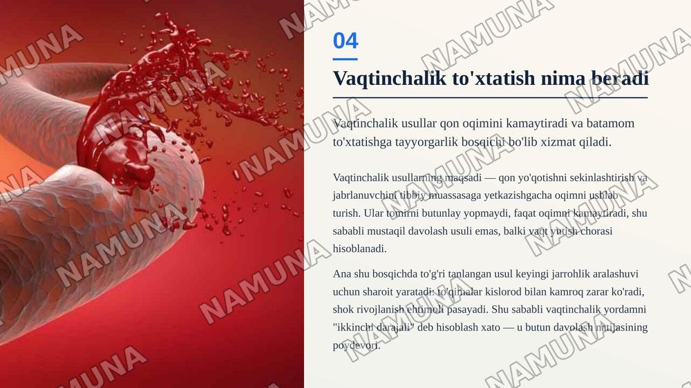 Qon ketishni vaqtincha va batamom to’xtatish usullari — zamonaviy taqdimot, 5-slayd
