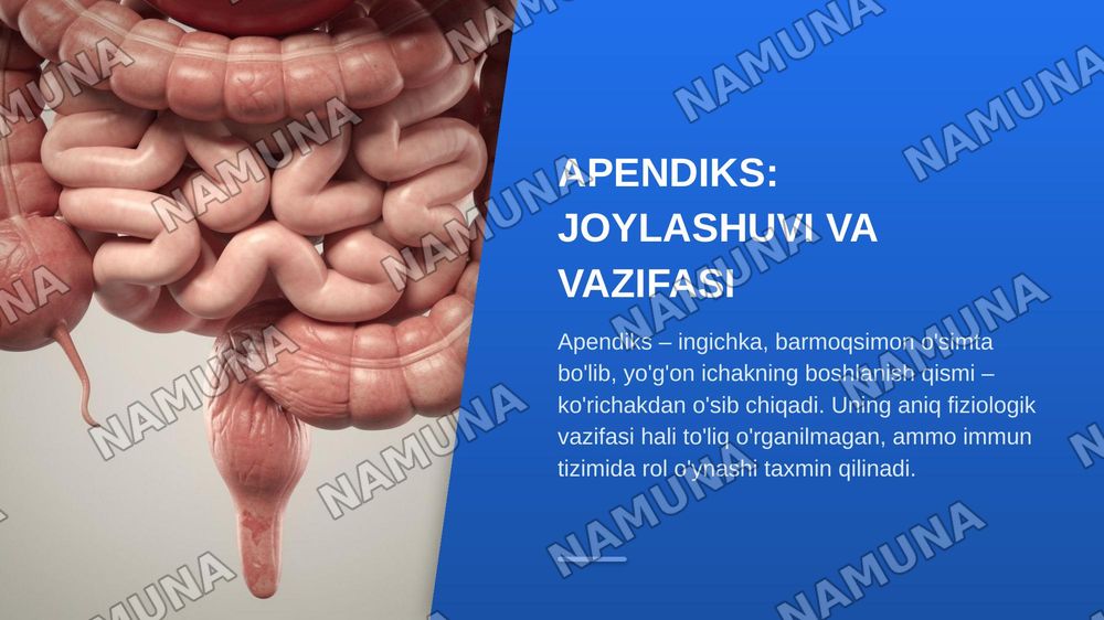 Apenditsit — zamonaviy taqdimot, 3-slayd