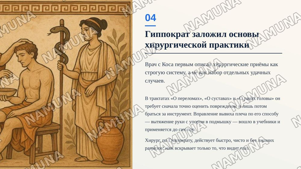 Хирургические методы в Древней Греции и Риме — zamonaviy taqdimot, 5-slayd