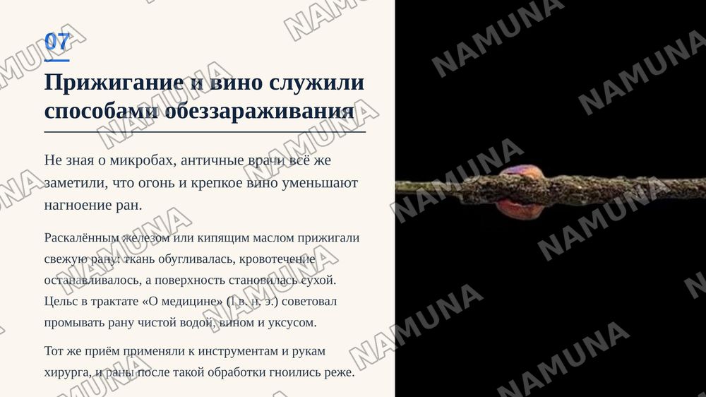 Хирургические методы в Древней Греции и Риме — zamonaviy taqdimot, 8-slayd