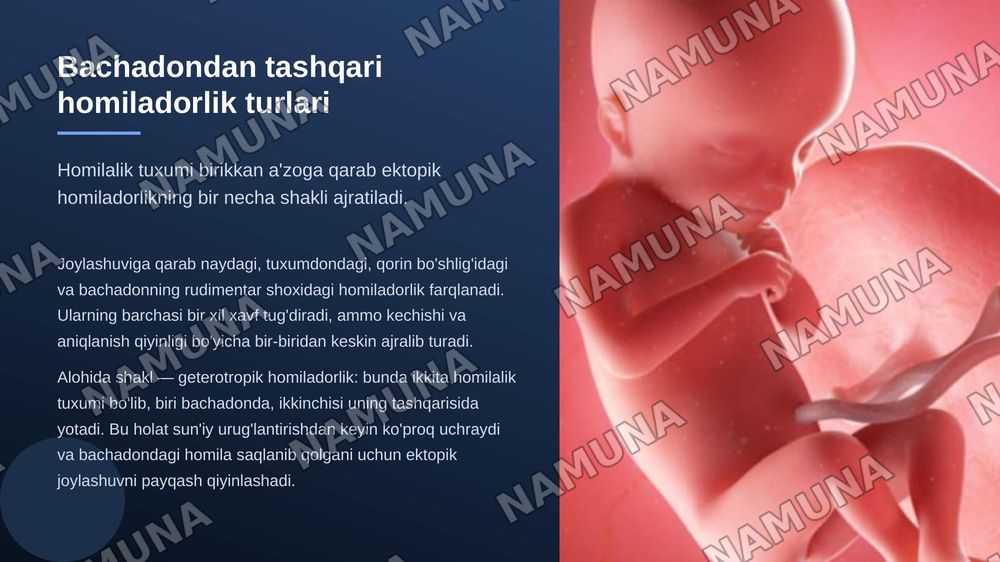 Bachadondan tashqari homiladorlik. Sabablari. Bachadondan tashqari homiladorlik turlari. Tashxislash va tekshirish usullari. — zamonaviy taqdimot, 8-slayd