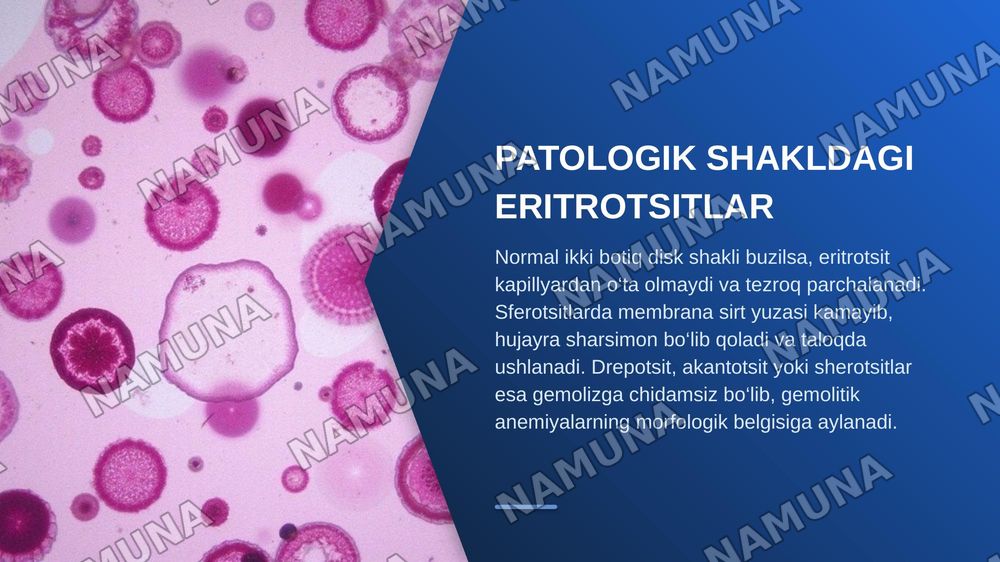 Qon patofiziologiyasi. Qon reologik xususiyatlarining o‘zgarishi. Eritrotsitlar, genez va patologik shakldagi eritrotsitlar. Turli xil anemiyalarda periferik qon manzarasini o‘rganish. — zamonaviy taqdimot, 8-slayd