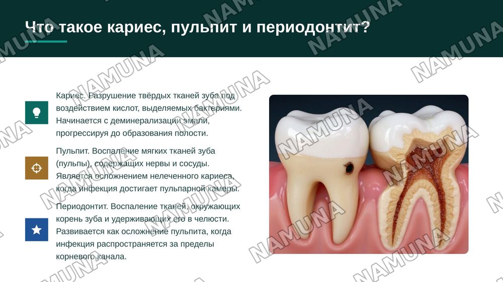 Карис пульпит переодантит вид анастизии зубы мудрости — zamonaviy taqdimot, 3-slayd
