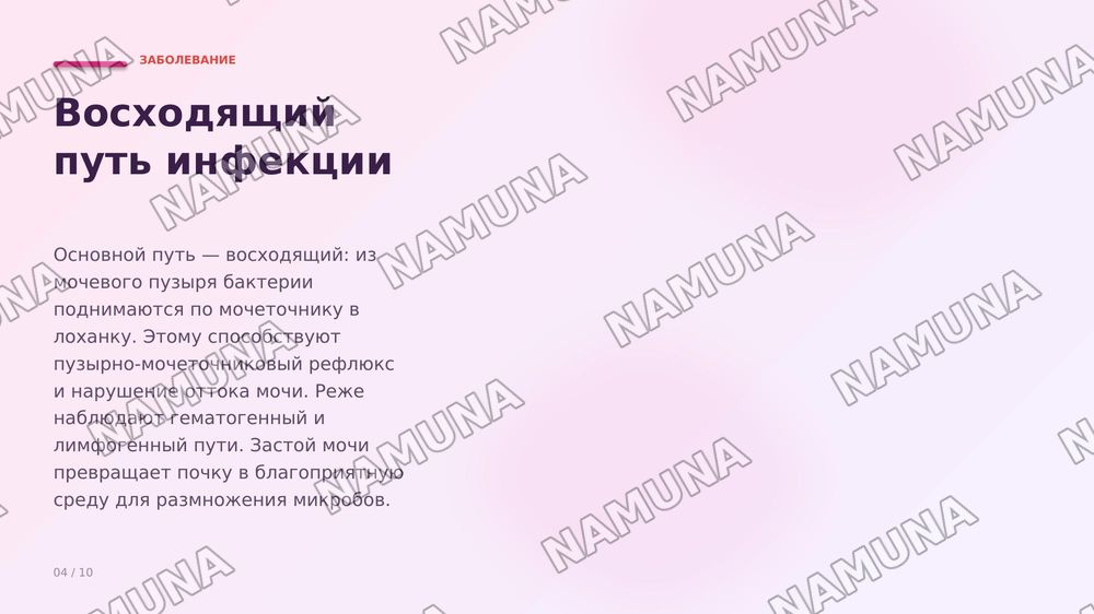 Пиелонефрит. По предмету паралогическая анатомия — zamonaviy taqdimot, 4-slayd