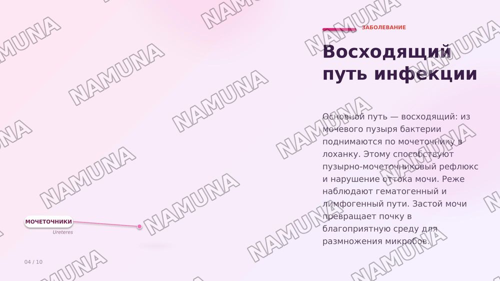 Пиелонефрит. По предмету паралогическая анатомия — zamonaviy taqdimot, 5-slayd