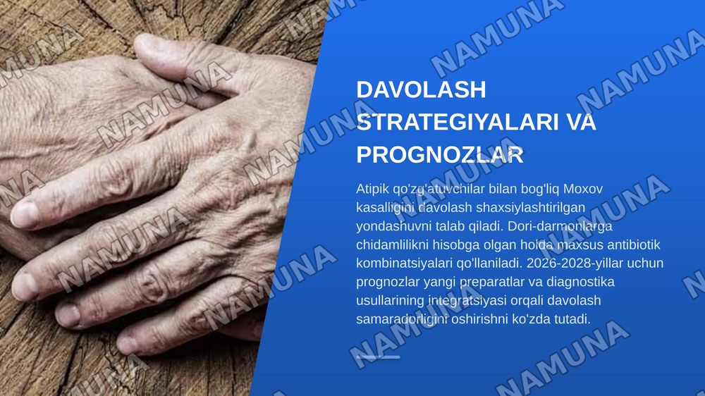 Atipik qo'zgatuvchilar Moxov kasalligi — zamonaviy taqdimot, 6-slayd