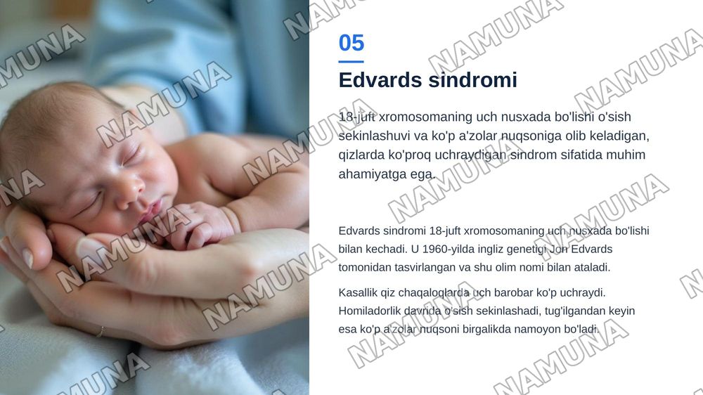 Odam autosoma kasalliklari,edvards va patau sindromi. — zamonaviy taqdimot, 6-slayd