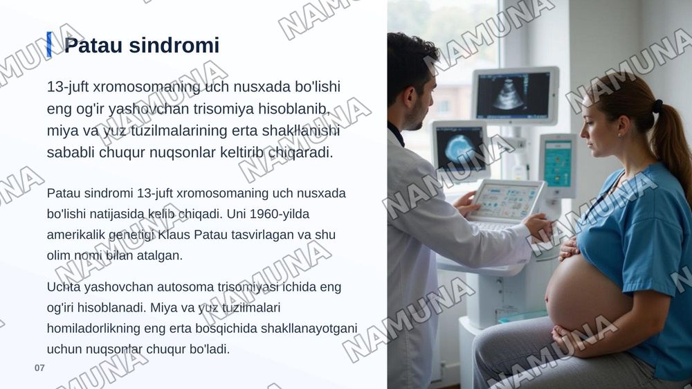 Odam autosoma kasalliklari,edvards va patau sindromi. — zamonaviy taqdimot, 8-slayd