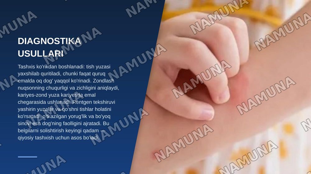 Yuza kariyes.
1.Yuza  kariesni etiologiyasi, patogenezi, klinikasi, diagnostika va davolash usullari. Yuza kariesni qiyosiy tashxislash.
2 — zamonaviy taqdimot, 5-slayd