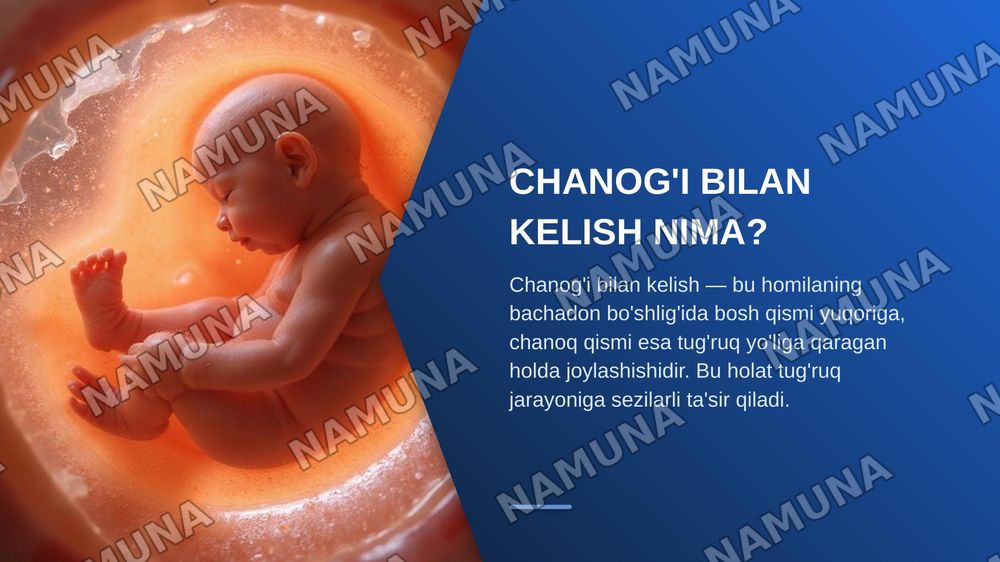 Homilaning chanog’i bilan kelishi. Tug’ruq biomexanizmi. Lovset va Moris-Smeyli-Veyta usullari. — zamonaviy taqdimot, 4-slayd