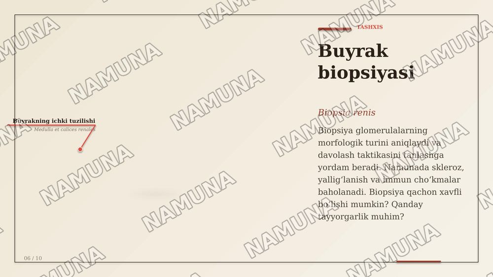 Сурункали гломерулонефрит — zamonaviy taqdimot, 7-slayd