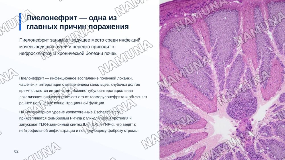 Пиелонефрит. По предмету патологическая анатомия — zamonaviy taqdimot, 3-slayd