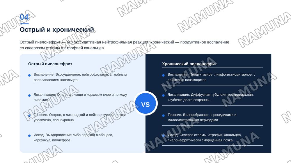 Пиелонефрит. По предмету патологическая анатомия — zamonaviy taqdimot, 5-slayd