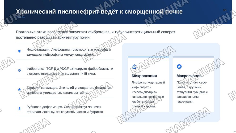 Пиелонефрит. По предмету патологическая анатомия — zamonaviy taqdimot, 7-slayd
