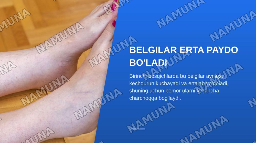 Oyoq qollarda qon aylanish faoliyatining buzulish sindromi varikoz — zamonaviy taqdimot, 7-slayd
