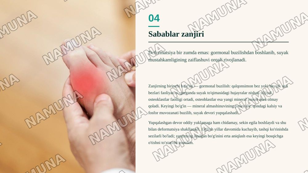 Suyak deformatsiyasi kelib chiqish sababi va kerakli dori vositalar kimyoviy tarkibi — zamonaviy taqdimot, 5-slayd