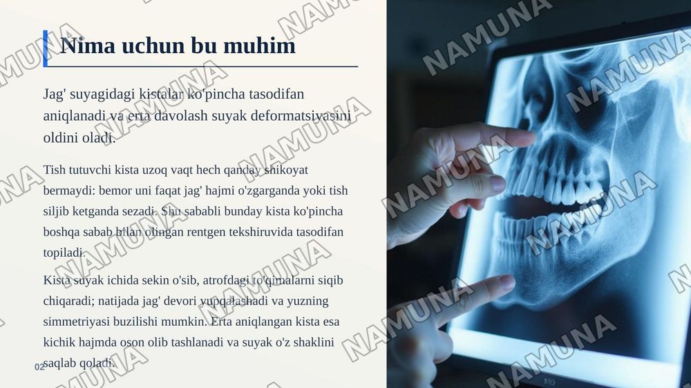 Birlamchi tish tutuvchi kistalar, ularning morfologiyasi, joylashuvi. — zamonaviy taqdimot, 3-slayd