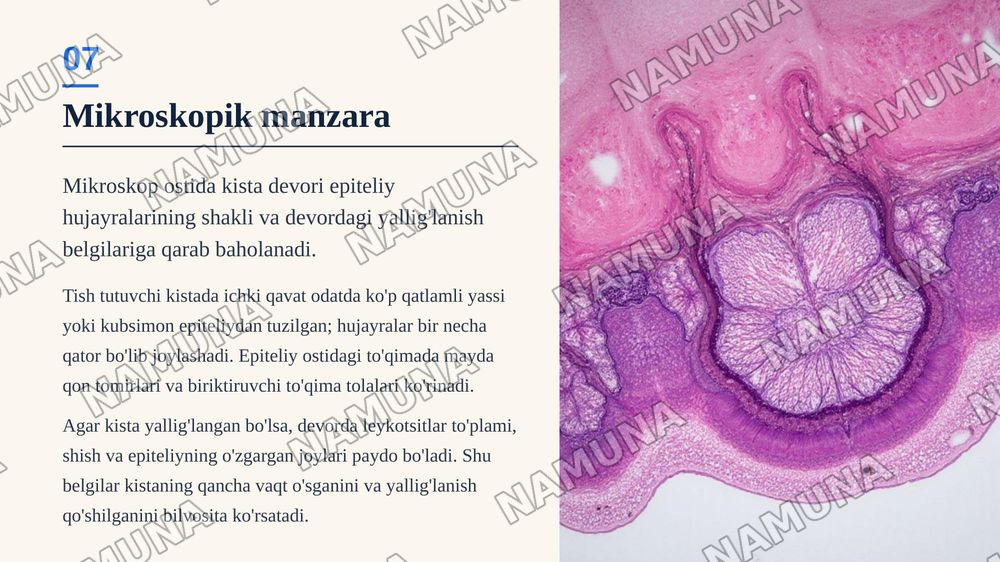 Birlamchi tish tutuvchi kistalar, ularning morfologiyasi, joylashuvi. — zamonaviy taqdimot, 8-slayd