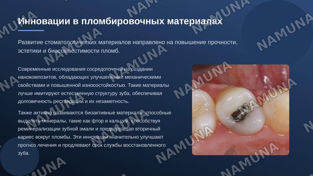 Пломбы — zamonaviy taqdimot, 8-slayd