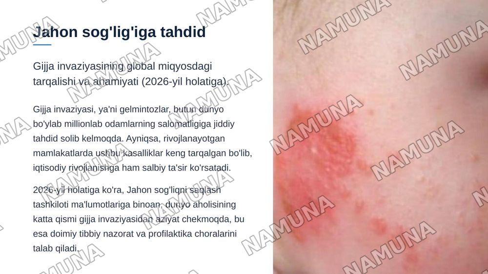 Gijja invaziyasi — zamonaviy taqdimot, 3-slayd