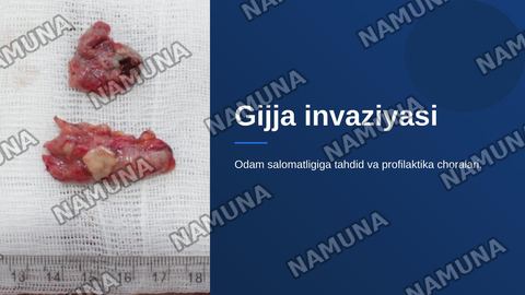 Gijja invaziyasi — zamonaviy taqdimot
