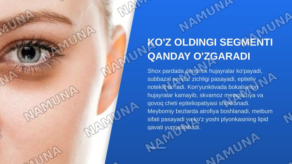 MIOPIYANI KONTAKTLI KORREKSIYA QILISHDA QURUQ KO'Z SINDROMI VA KO'Z OLDINGI SEGMENTINING KLINIK-MORFOMETRIK O'ZGARISHLARI — zamonaviy taqdimot, 7-slayd